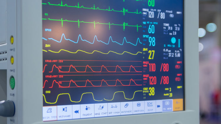 elecrocardiography